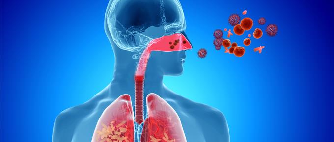 Situación de las enfermedades respiratorias agudas es de aumento moderado: Salud