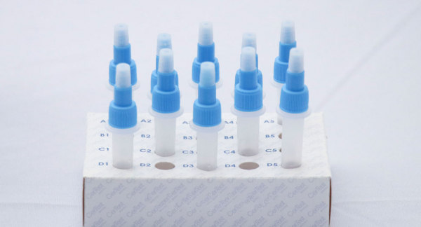 Reporta Salud dos nuevos contagios de COVID-19 en las últimas 24 horas