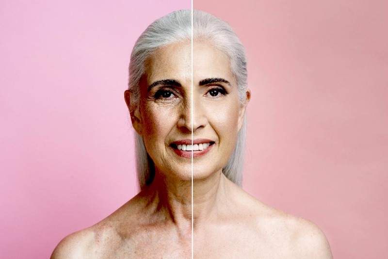 Aumenta en casi 10 por ciento demanda de  radiofrecuencia facial en México