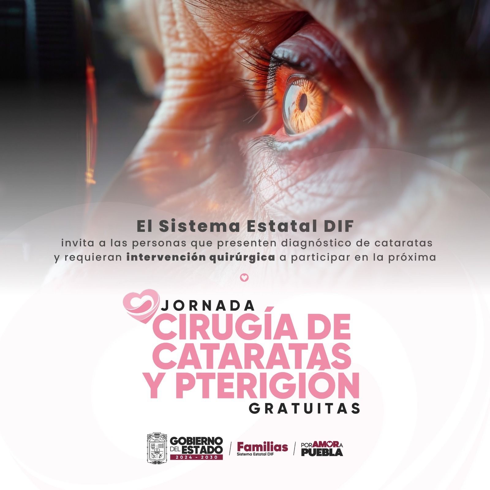 El SEDIF realizará jornada gratuita de cirugías oculares